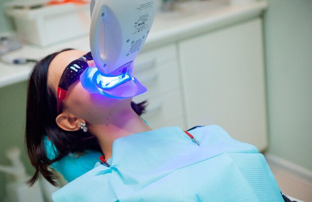 تبييض الأسنان بالليزر