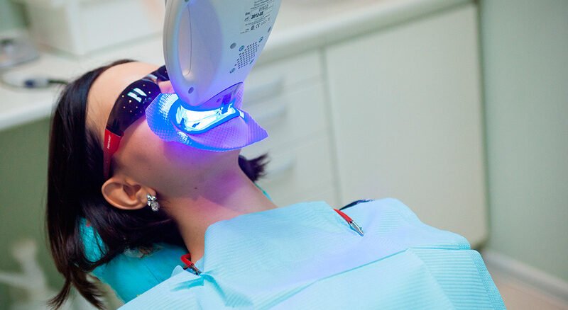 تبييض الأسنان بالليزر
