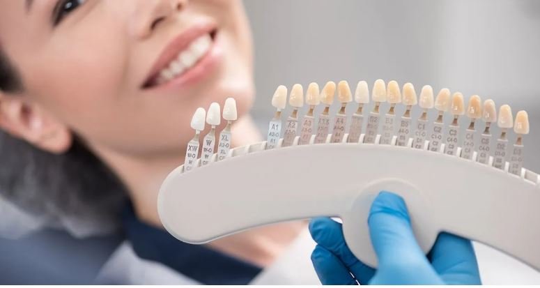 zirconia veneers