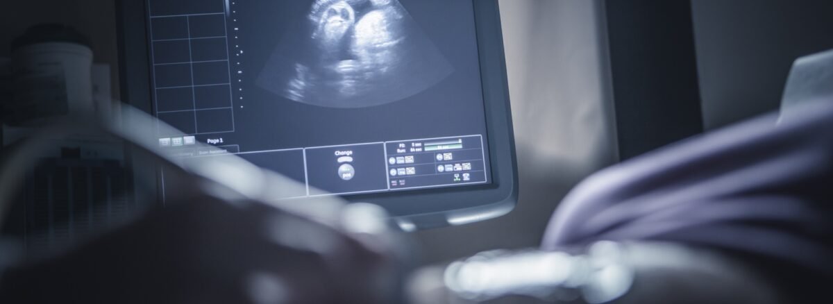 أنواع السونار للحمل