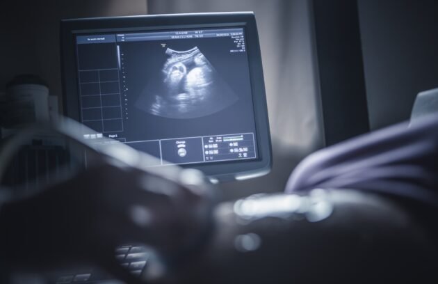 أنواع السونار للحمل