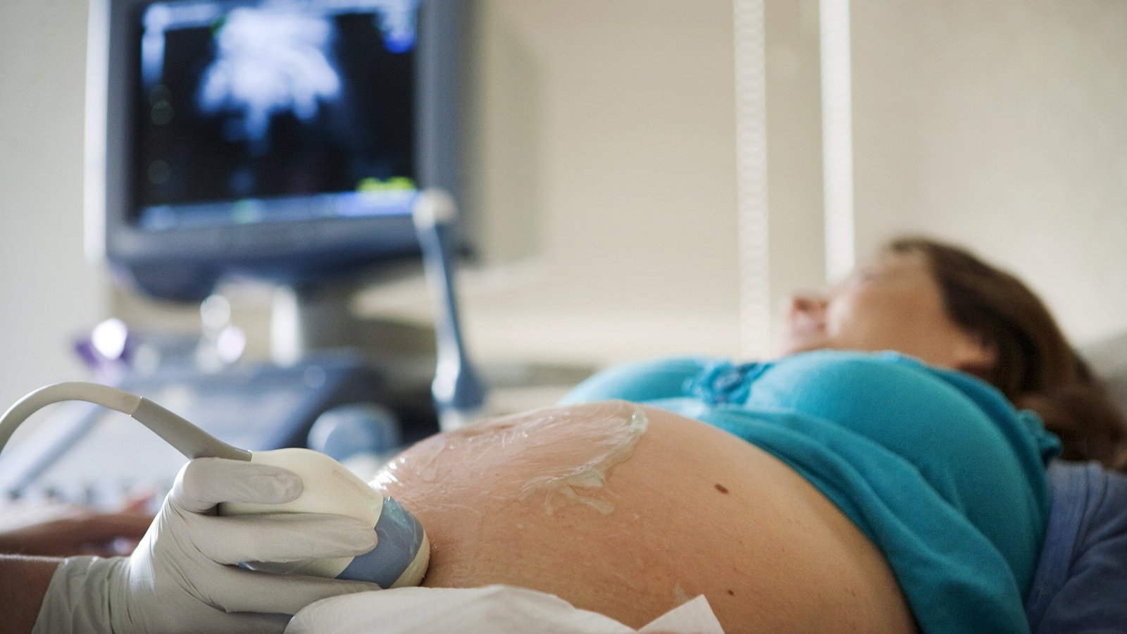 أنواع السونار للحمل