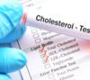 Cholesterol Test