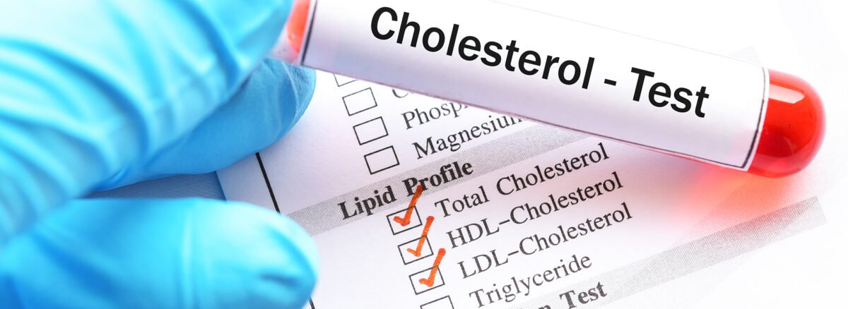 Cholesterol Test