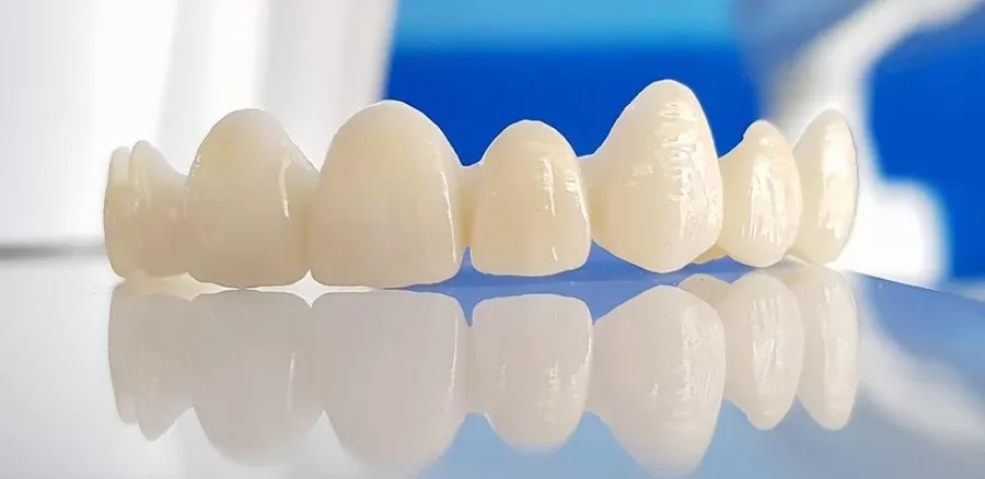Zirconium veneers